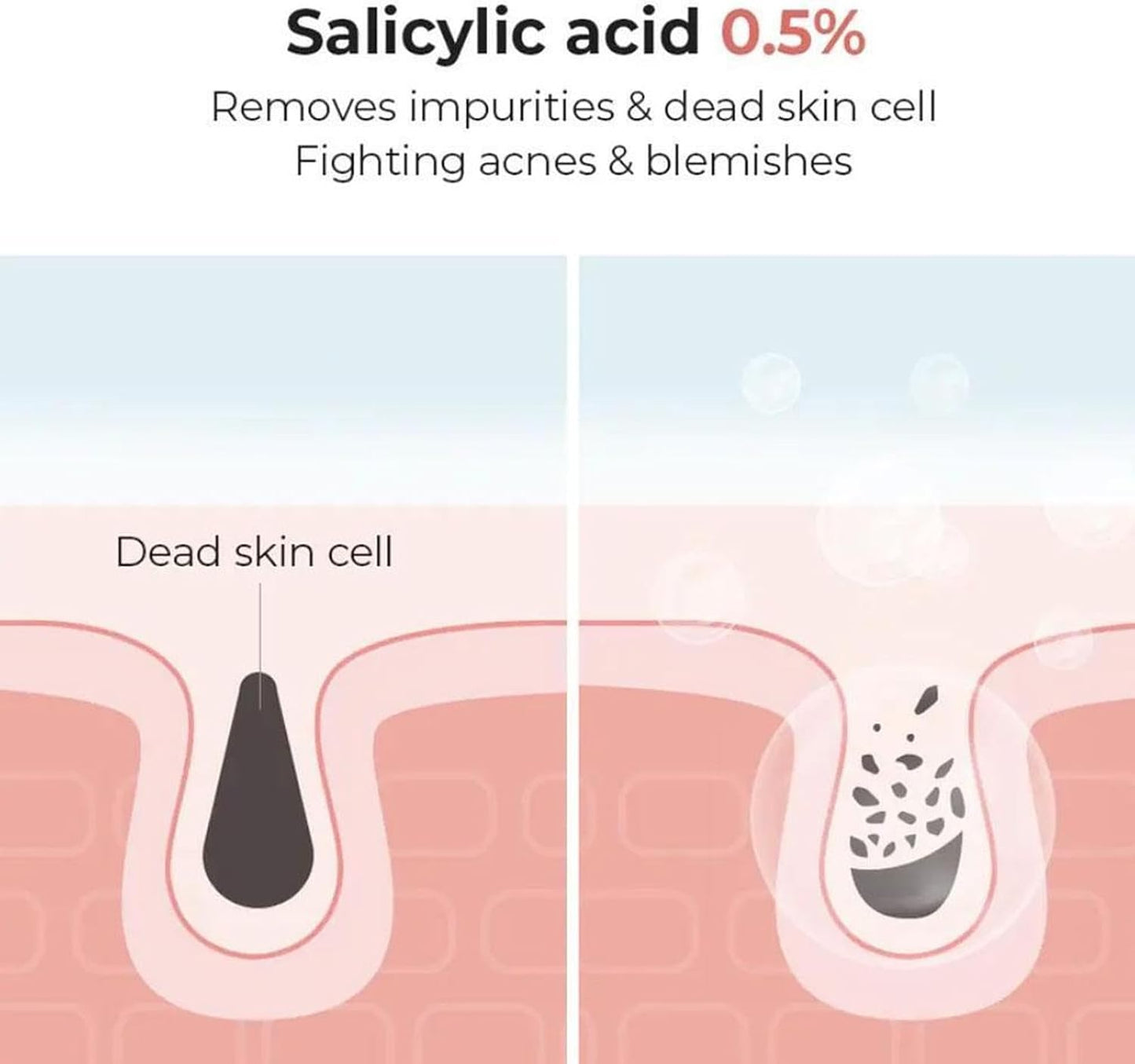 COSRX Salicylic Acid Daily Gentle Cleanser – 150ml foaming acne cleanser with 0.5% BHA
