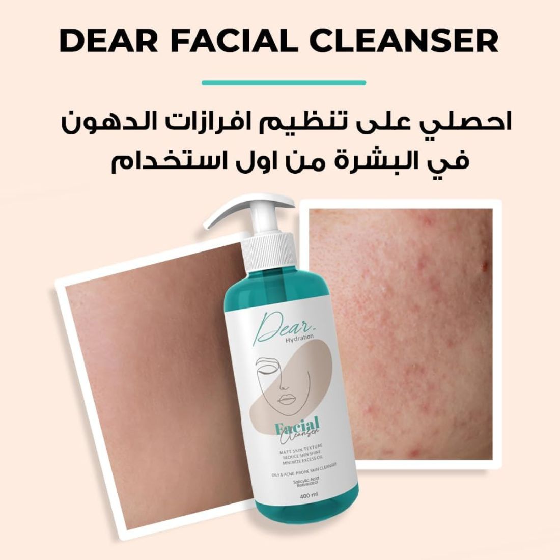 Dear Facial Cleanser – For Oily & Acne-Prone Skin – 400ml packaging
