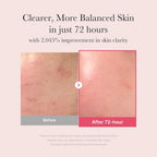 Medicube TXA + Niacinamide 15% Serum 30ml brightening Korean face serum for dark spots and uneven tone
